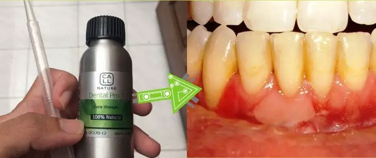 Where Can I Buy Dental Pro 7 And More Importantly, Does It Work?