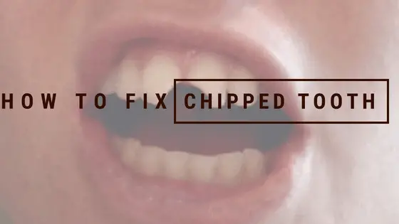 can chipped tooth be fixed