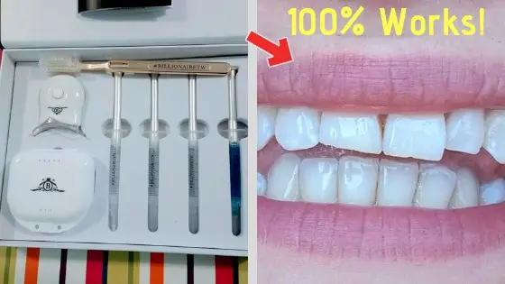 Only 7 Days To Whiten My Teeth With The Billionaire Teeth Whitening Kit!