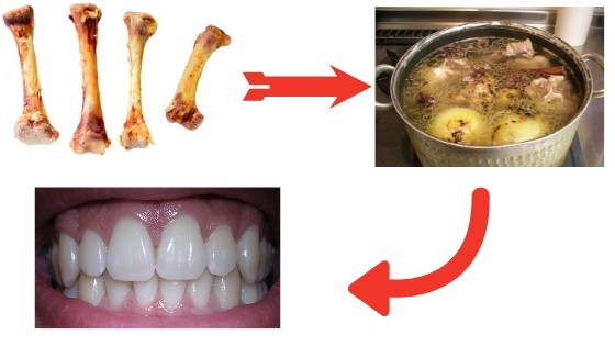 How To Make A Simple Bone Broth For Teeth Mineralisation?