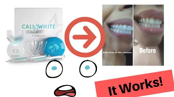 Cali white teeth whitening kit review