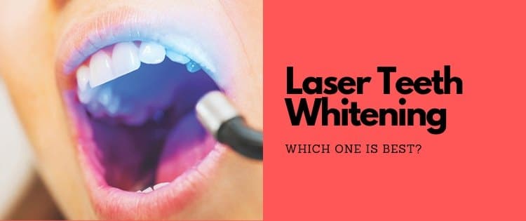 What Is The Best Laser Teeth Whitening System [Shocking ...