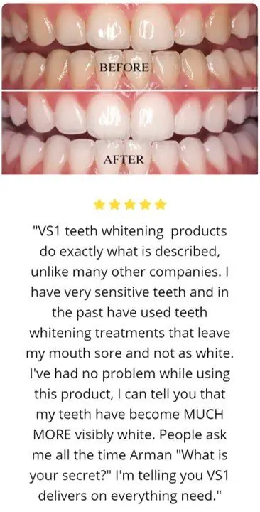 Vs1 teeth whitening reviews