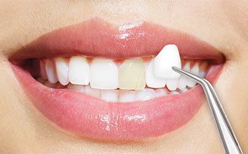 receding gums from braces