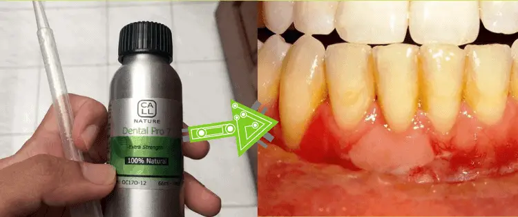 dental pro 7 vs oramd